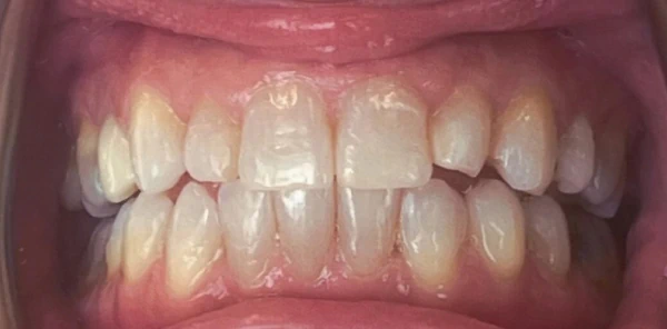 After — case 1