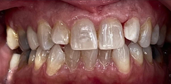 Before — case 1