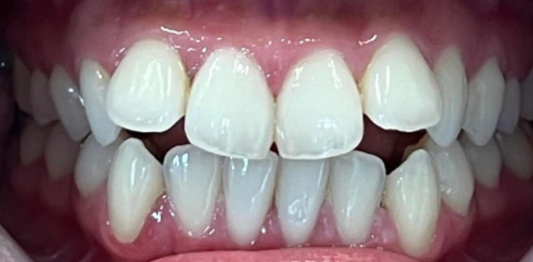Before — case 2