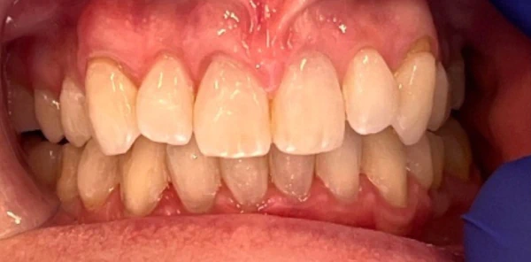 After — case 4