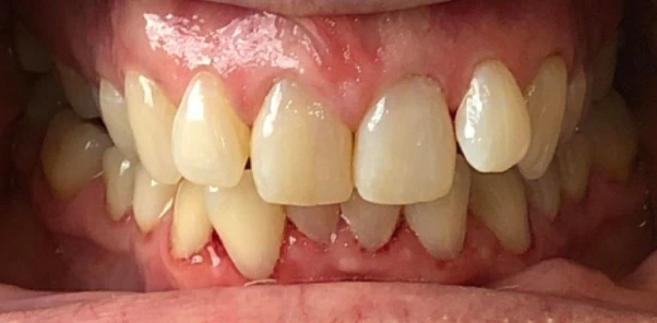 Before — case 4