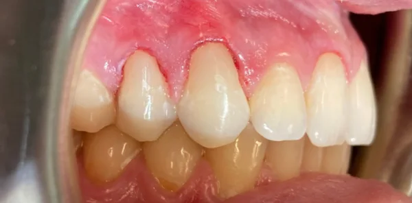 After — case 5