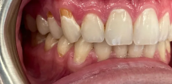 Before — case 5
