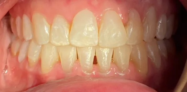 After — case 6