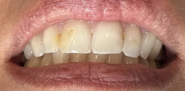 Before — case 7