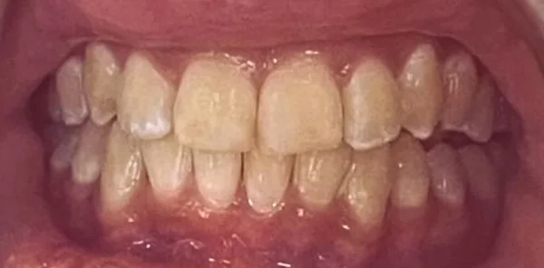 After — case 8