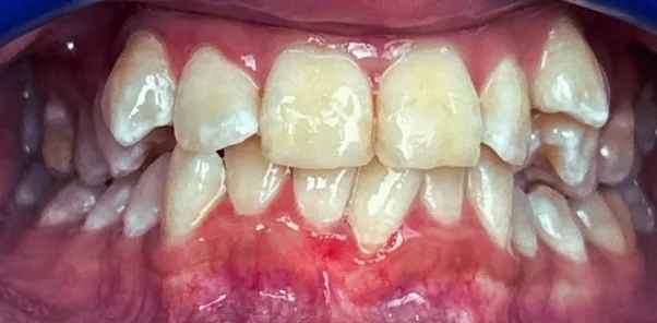 Before — case 8