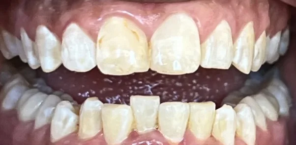 Before — case 9