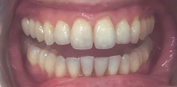 After — case 10