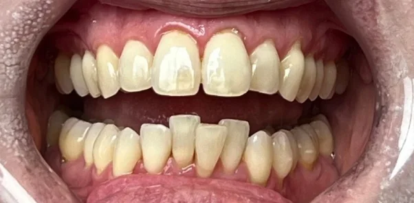 Before — case 10