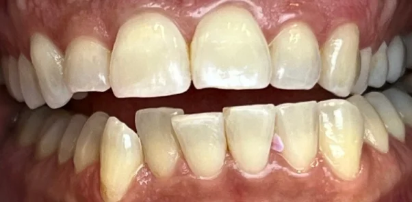 Before — case 11