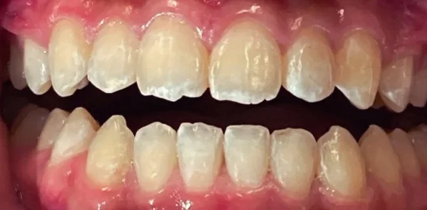 After — case 12