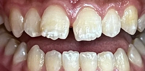 Before — case 12
