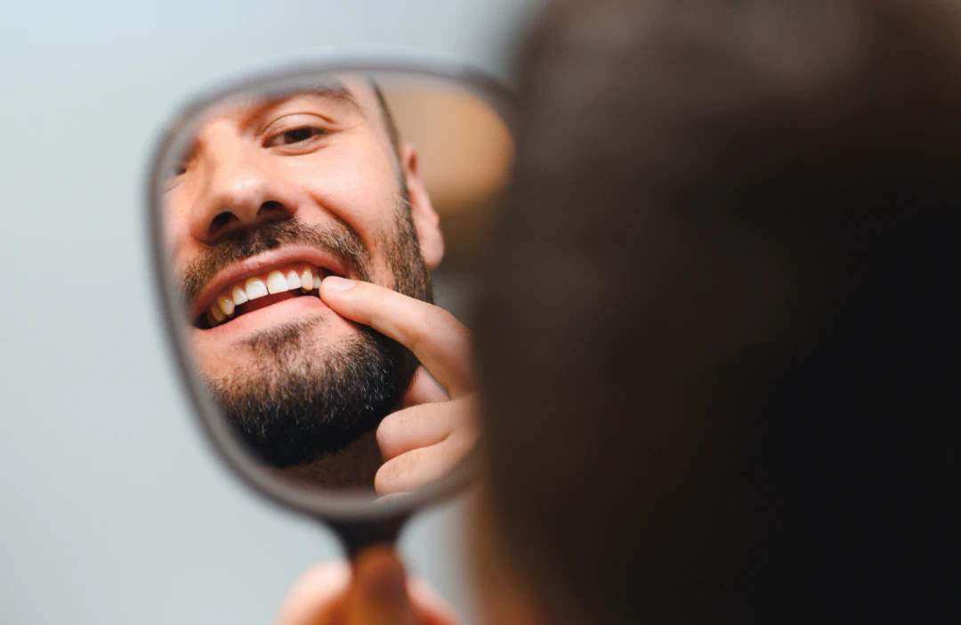 A man with a beard looks at his teeth in a small handheld mirror, using his finger to point at them while smiling.